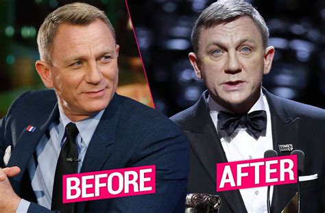 Daniel Craig Flaunts Freaky New Face After Plastic Surgery Disaster