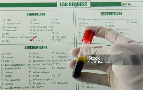 Specimen Blood Sample Stock Photo Download Image Now Blood