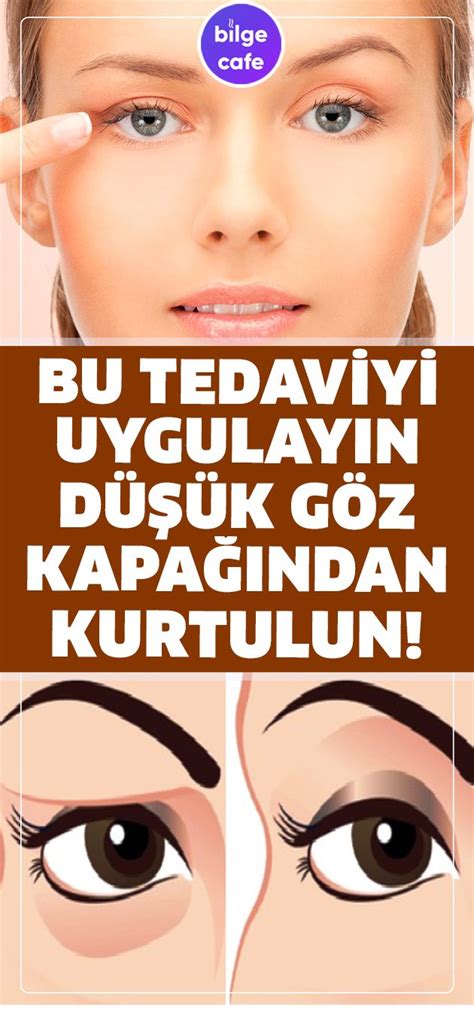 Bu Tedaviyi Uygulayın ve Düşük Göz Kapaklarından Kurtulun (Görüntüler