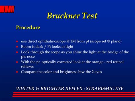 Ppt Diagnosis Of Strabismus And Amblyopia In A Primary Care Setting