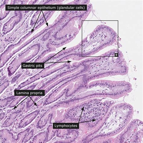Stomach Histology Gastric Pits Basic Anatomy And Physiology Tissue