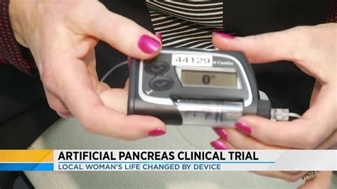 Artificial Pancreas Improves Daily Life Of Type 1 Diabetes