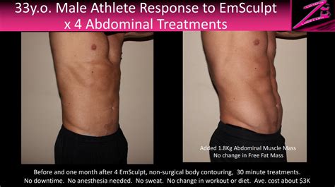 Candidates can get results online and from mobile sms. Emsculpt Awarded 'Most Innovative Device' - AHB