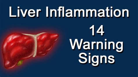 Inflammation Of The Liver
