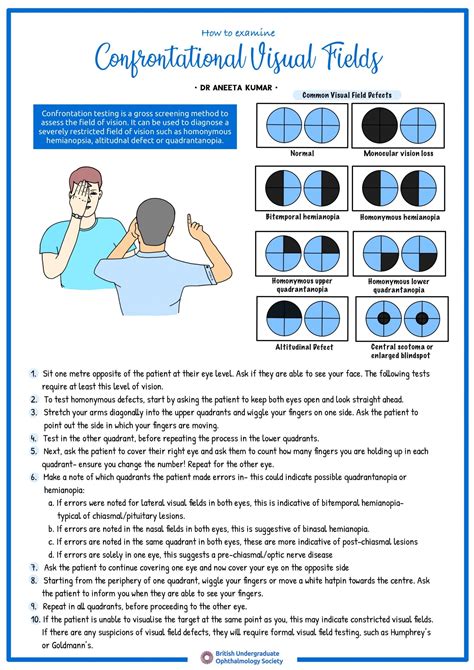 How To Examine Confrontational Visual Fields British Undergraduate