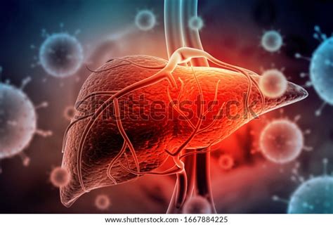 Hepatitis Virus Human Liver 3d Illustration Stock Illustration 1667884225