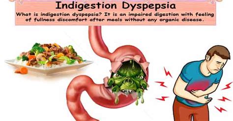 Dyspepsia Indigestion Functional Dyspepsia