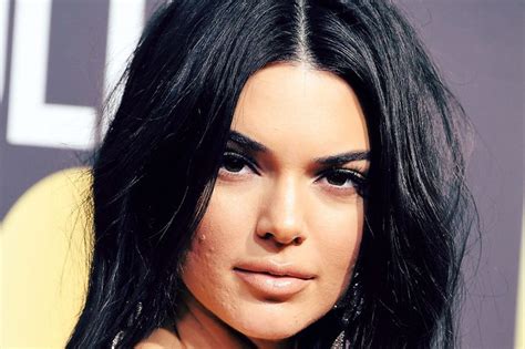 In 2019, plastic surgery and cosmetic procedures do not have the same type of stigma attached to them as they did 20 years ago. Kendall Jenner Responds to People Criticizing Her Acne