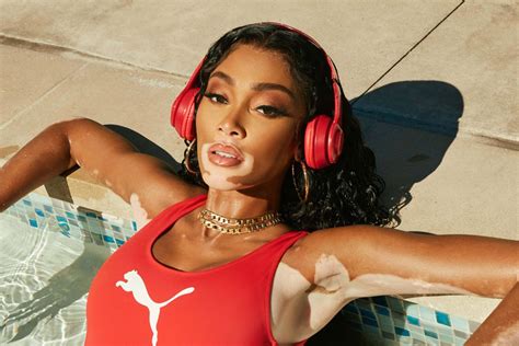 Winnie Harlow Showcases Her Incredible Physique As She Models Hot Pink Crop Top And Tight Shorts