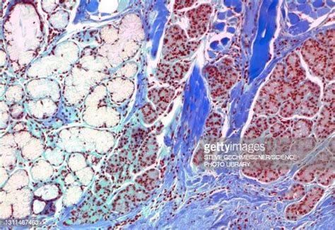 Sublingual Salivary Gland Photos And Premium High Res Pictures Getty