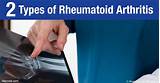 Chemo Drug Used For Rheumatoid Arthritis