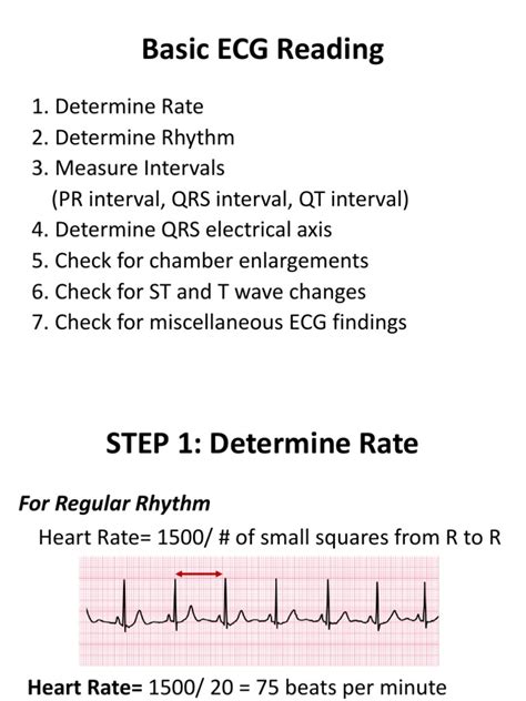 Basic Ecg Reading Electrocardiography Heart Rate