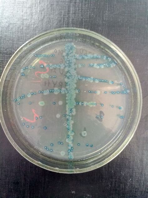Pseudomonas Aeruginosa And Enterococcus Faecalis Microbiology Lab