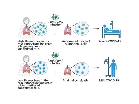Biomarker Predicts Severity Of Covid 19 Infection Early On Max Planck