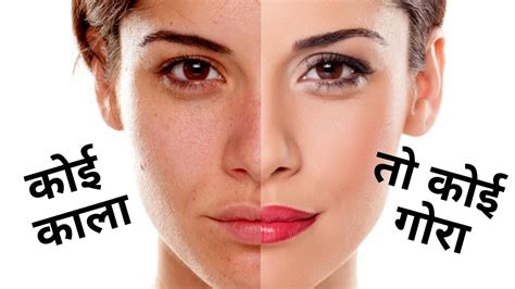 Why Did Darker And Lighter Human Skin Colors Evolve Explain In Hindi