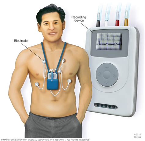 Monitor Holter