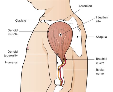 Figure Anatomical Markers Used To Identify The Deltoid Injection Site The Australian
