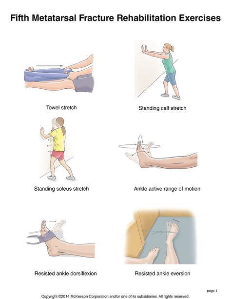 Summit Medical Group - Foot Fracture: Fifth Metatarsal ...