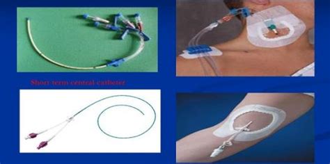 Central Venous Access Devices Made Incredibly Easy