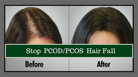 A feeling of general discomfort called malaise. HOW TO STOP HAIR FALL NATURALLY | How to stop hair loss ...