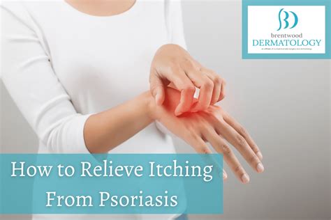 How To Relieve Itching From Psoriasis Brentwood Dermatology