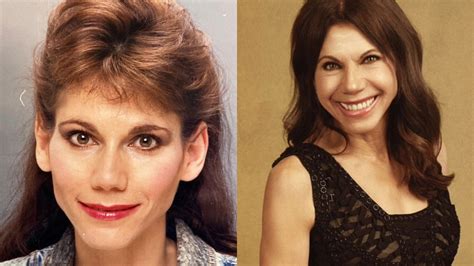 Theresa Nist Plastic Surgery