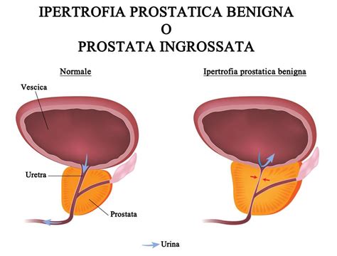 Anatomia Da Prostata