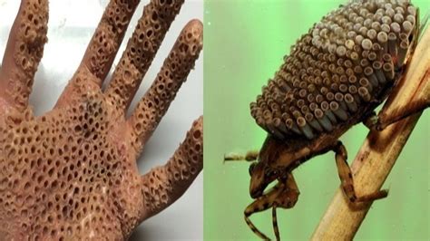 Trypophobia World Most Dangerous Poisonous Insect