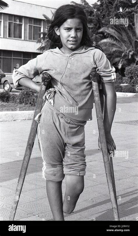 Young Amputee Girl On Crutches Stock Photo 139430510 Alamy