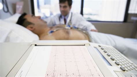 Examen Electrocardiograma
