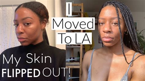 I Had To Repair My Dry Skin After Moving To La 4 Days Youtube