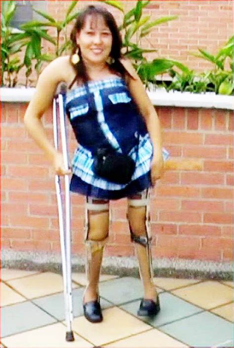 Pin By Eklof On Disabled Ladies Braces Girls Women Leg Braces