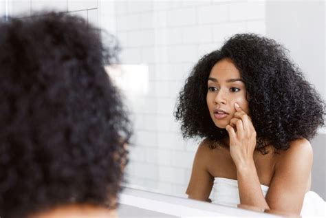 How People Of Color Can Diagnose Common Skin Conditions