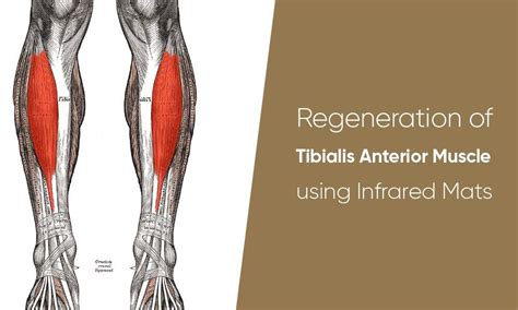 Regeneration Of Tibialis Anterior Muscle With Infrared Mat Contrast