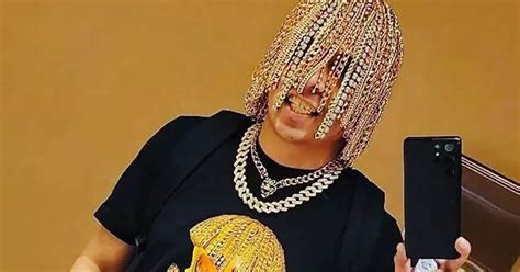 Rapper Dan Sur Has Gold Chains Surgically Attached To His Head Instead