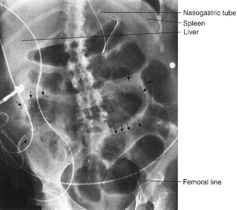 Abdomen Radiology Key