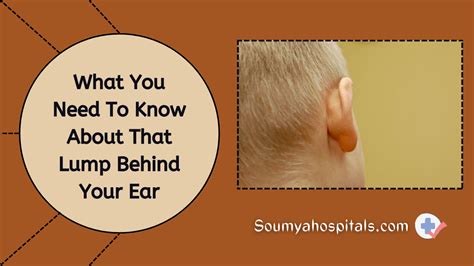 What You Need To Know About That Lump Behind Your Ear