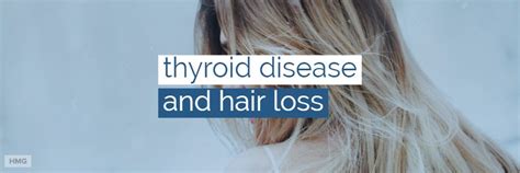 Thyroid conditions are seen in people with alopecia, which causes patchy hair loss. Can Thyroid Disease Cause Hair Loss? + Tips for Hair ...