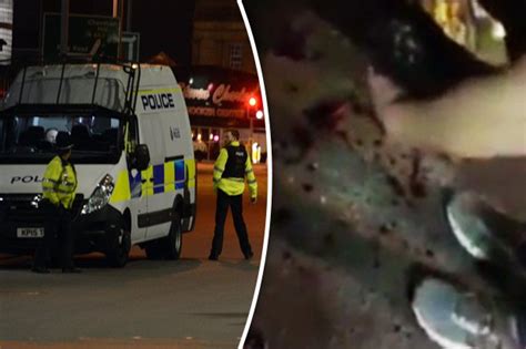 Graphic Video Footage Shows Horrific Injuries From