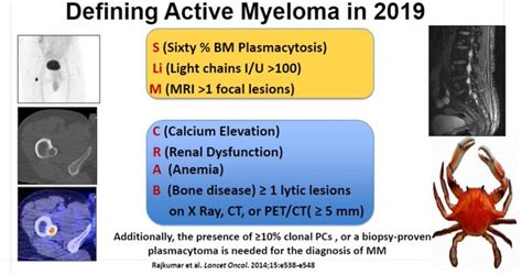 Diagnosis Of Active Multiple Myeloma Is Not Just Crab Grepmed