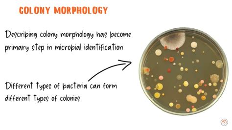Bacterial Colony Morphology With Live Examples Youtube