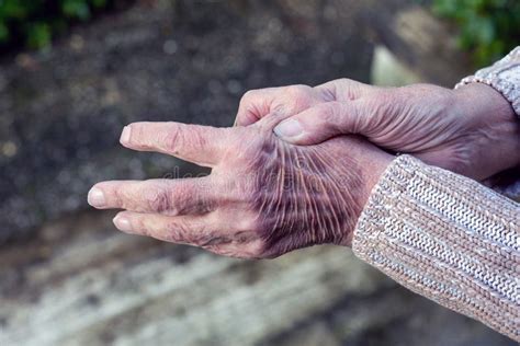 Close Up Of Old Woman Rubbing Her Hands Stock Image Image Of