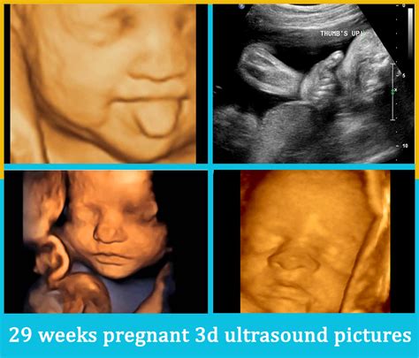 29 Weeks Pregnant Ultrasound