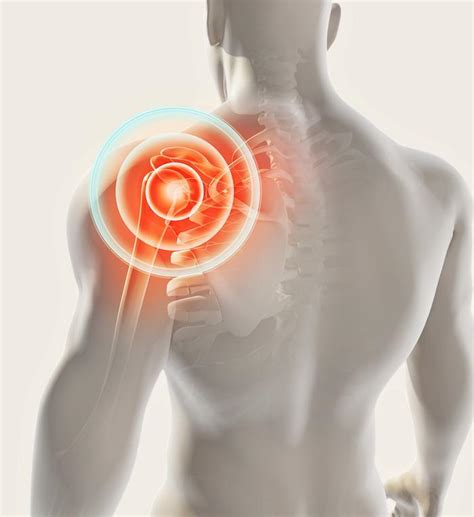 What Causes Shoulder Pain Steven Grossinger Do Pain Management