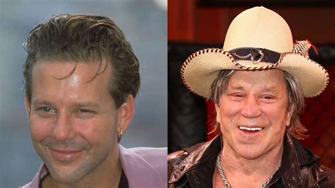 What Happened To Mickey Rourke Face Surgery Before And After Boxing