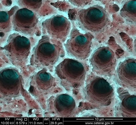 Amazing Electron Microscope Images Onelargeprawn