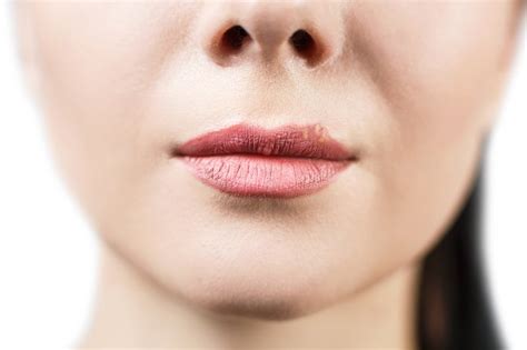 How long do i leave the toothpaste on there ? Differences Between Cold Sores & Herpes | LIVESTRONG.COM
