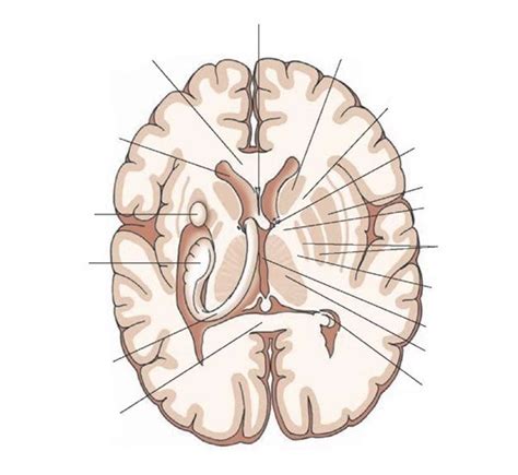 Transverse Section Of The Brain Diagram Quizlet