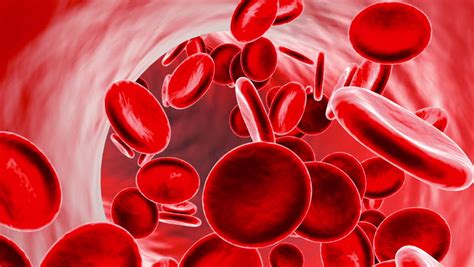 Anemia Hemolitica Causas Sintomas E Tratamentos Dicas De Musculacao Images