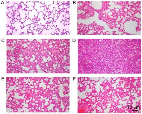 Representative Rat Lung Tissue Histological Sections From Control